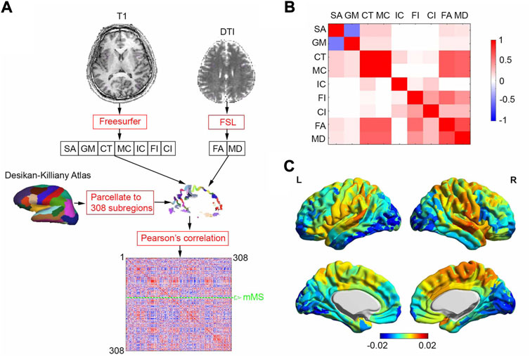 Morphometric similarity networks discriminate patients with lumbar disc herniation from healthy controls and predict pain intensity